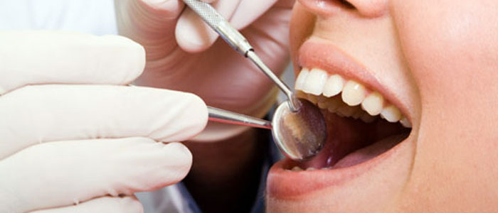 wisdom teeth removal los angeles